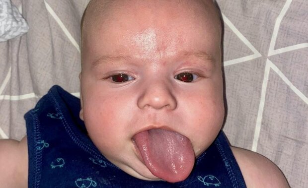 Мальчик с длинным языком, фото: Facebook